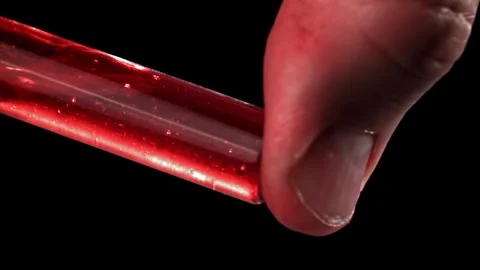 Blood Sample Inside a Glass Vial Held by a Person for Medical Examination 库存影片 331101737