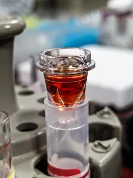 Blood sample in the Laboratory Stock Photos