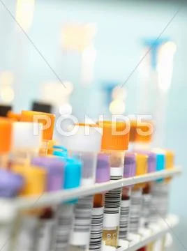 Blood Sample For Medical Testing In Laboratory