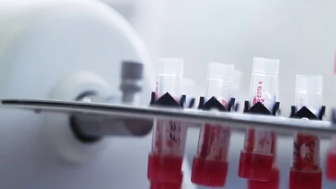 Blood sample in micro tubes Stock Footage 76129546