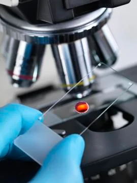 Blood sample on microscope slide Stock Photos