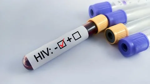 Blood sample negative with HIV testing Stock Photos