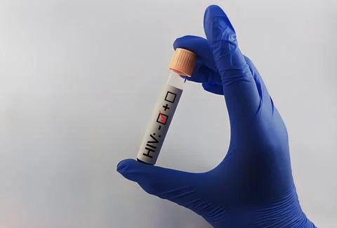 Blood sample negative with HIV testing Stock Photos