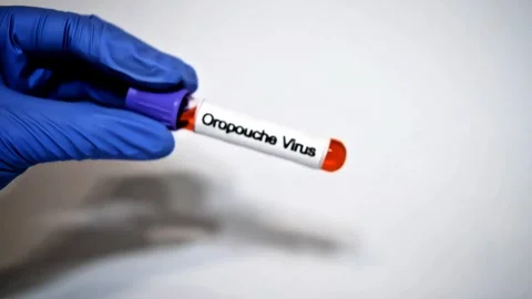 Blood sample for Oropouche virus Test to diagnosis of Oropouche virus disease Stock Footage 307332326