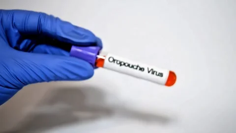 Blood sample for Oropouche virus Test, medical and health concept Stock Footage 307332329