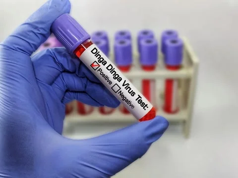 Blood sample of patient positive test for Dinga Dinga virus. Stock Footage 296902720