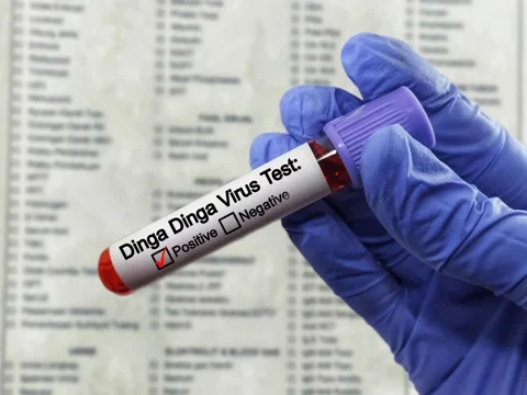 Blood sample of patient positive test for Dinga Dinga virus. Stock Footage 296902743