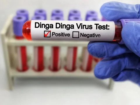 Blood sample of patient positive test for Dinga Dinga virus. Stock Footage 296902757