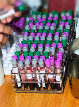 Blood sample Stock Photos