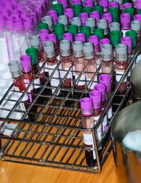 Blood sample Stock Photos