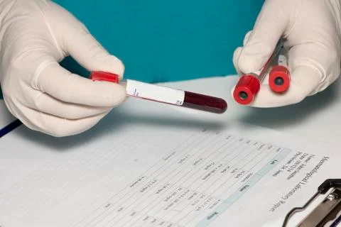 Blood sample Foto stock