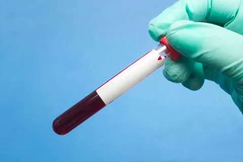 Blood sample Stock Photos