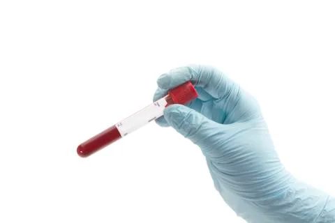 Blood Sample Stock Photos