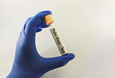 Blood sample for polio virus testing Stock Photos