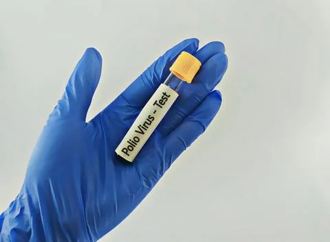 Blood sample for polio virus testing Foto stock