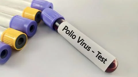 Blood sample for polio virus testing Foto stock
