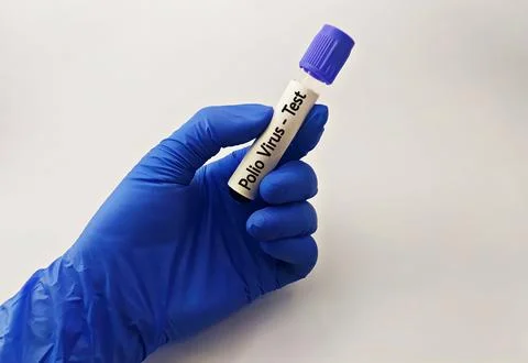 Blood sample for polio virus testing Stock Photos