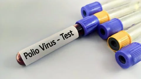 Blood sample for polio virus testing Stock Photos