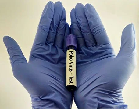Blood sample for polio virus testing Stock Photos