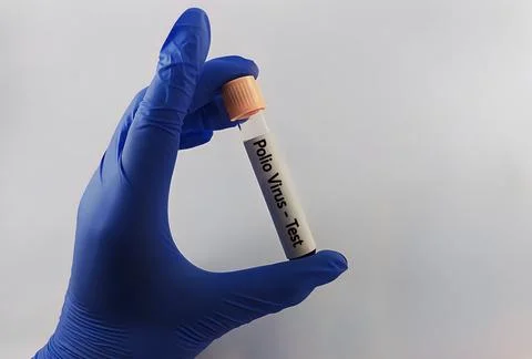 Blood sample for polio virus testing Stock Photos