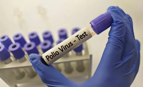 Blood sample for polio virus testing Stock Photos