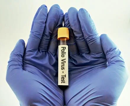 Blood sample for polio virus testing Stock Photos