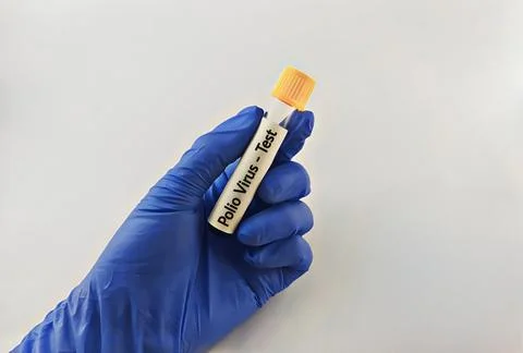 Blood sample for polio virus testing Stock Photos