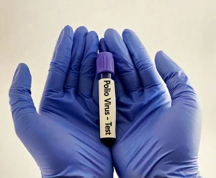 Blood sample for polio virus testing Stock Photos
