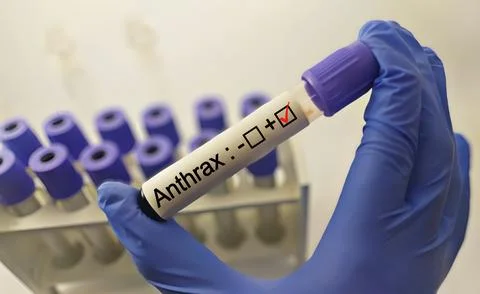 Blood sample positive with anthrax testing Stock Photos