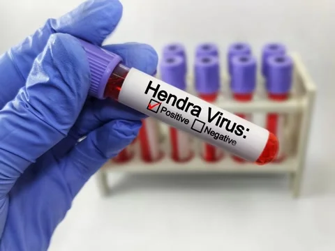 Blood sample positive with Hendra virus Stock Footage 296902682