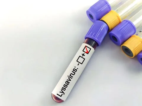 Blood sample positive with Lyssavirus Stock Footage 296902567