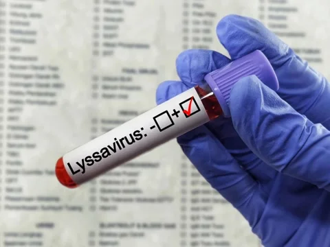 Blood sample positive with Lyssavirus Stock Footage 296902602