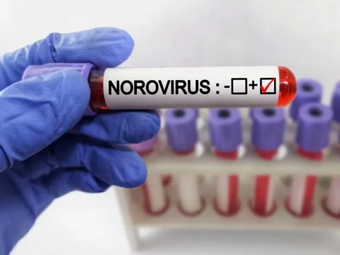 Blood sample positive with Norovirus Stock Footage 299831407
