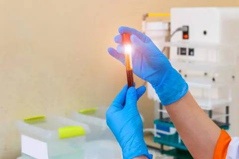 Blood sample for research in microtube. Testing in laboratory. Chemical resea Stock Photos