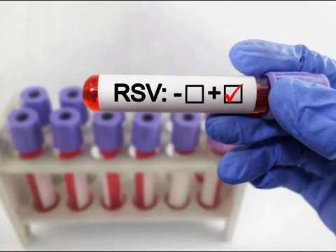 Blood sample for respiratory syncytial virus (RSV) test Stock Footage 295129145