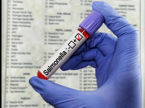 Blood sample for Salmonella bacteria test, Typhoid fever test Stock Footage 304620377