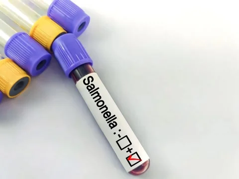 Blood sample for Salmonella bacteria test, Typhoid fever test Stock Footage 304620581