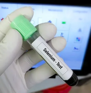 Blood sample for Selenium test 스톡 사진