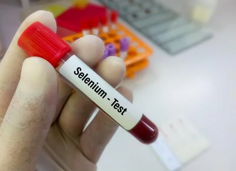 Blood sample for Selenium test. 스톡 사진