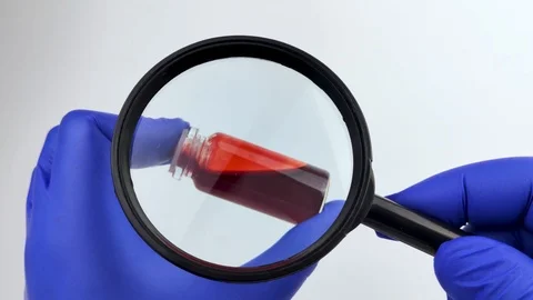 Blood sample for test. The doctor’s hand holds a magnifying glass in which a tes Stock Footage 125393893