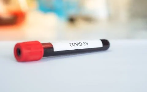 Blood sample in test tube for COVID-19 analyzing. Stock Photos
