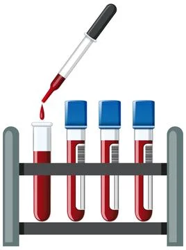 Blood Sample Test Tubes and Dropper in Rack Illustrazione stock