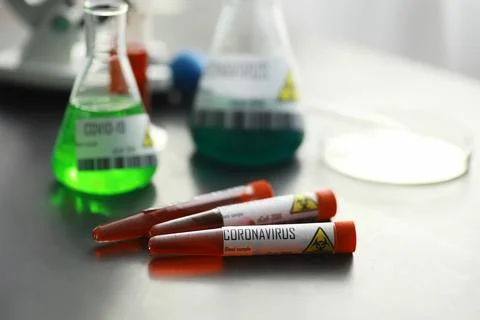 A blood sample for testing the dangerous virus coronavirus in the body. Tes.. Stock Photos