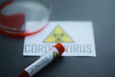 A blood sample for testing the dangerous virus coronavirus in the body. Tes.. Stock Photos