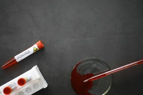A blood sample for testing the dangerous virus coronavirus in the body. Tes.. Stock Photos
