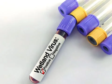 Blood sample for Tick-borne Wetland virus test. Stock Footage 292408710