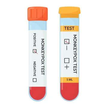 Blood sample tube for Monkeypox virus test. Positive or negative test. Test Stock Illustration