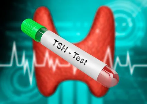 Blood sample tube for testing thyroid stimulating hormone. TSH test. イラスト素材