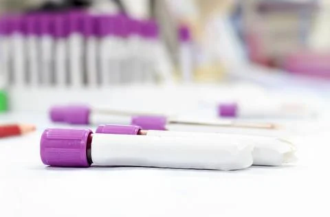 Blood sample tubes. over light [blur and select focus background] Stock Photos