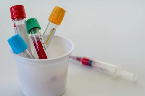 Blood sample tubes on the white background. Stock Photos